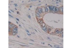 IHC-P analysis of Human Tissue, with DAB staining. (Oncostatin M Receptor Antikörper  (AA 513-760))