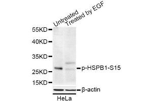 Western blot analysis of extracts of HeLa cells, using Phospho-HSPB1-S15 antibody (ABIN5969897) at 1/1000 dilution. (HSP27 Antikörper  (pSer15))