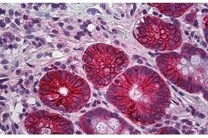 anti-Claudin 4 (CLDN4) (C-Term) antibody