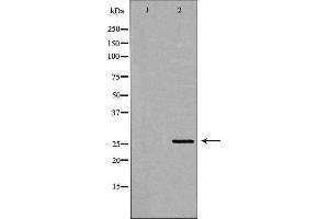 Western blot analysis of transfected 293T cell line, using ELSPBP1 Antibody. (ELSPBP1 Antikörper  (C-Term))
