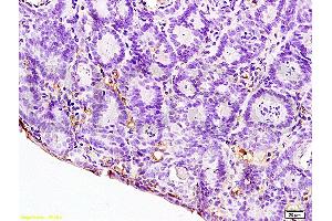 Formalin-fixed and paraffin embedded rat colitis labeled with Anti-IL-12 Polyclonal Antibody, Unconjugated (ABIN672951) at 1:200, followed by conjugation to the secondary antibody and DAB staining (IL12A Antikörper  (AA 51-150))
