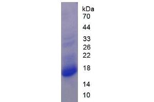 SDS-PAGE of Protein Standard from the Kit  (Highly purified E. (PRO-ANP ELISA Kit)