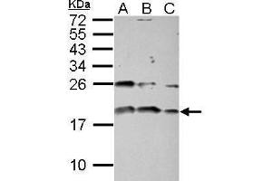 WB Image Sample (30 ug of whole cell lysate) A: PC-3 B: U87-MG C: SK-N-SH 15% SDS PAGE antibody diluted at 1:1000 (IGF1 Antikörper)