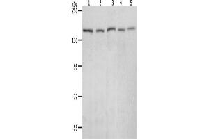 Western Blotting (WB) image for anti-RAD50 Homolog (S. Cerevisiae) (RAD50) antibody (ABIN2426374) (RAD50 Antikörper)