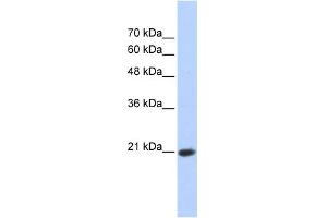 WB Suggested Anti-TCEAL8 Antibody Titration:  0. (TCEAL8 Antikörper  (Middle Region))