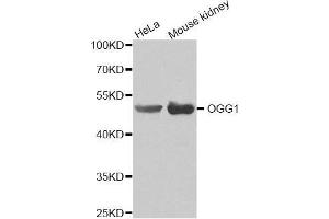 Western blot analysis of extracts of various cell lines, using OGG1 antibody(1:200). (OGG1 Antikörper)