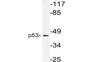 Western blot (WB) analysis of p53 antibody in extracts from HT-29 cells. (p53 Antikörper)