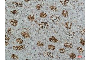 Immunohistochemical analysis of paraffin-embedded Human Kidney Tissue using IκB βMouse mAb diluted at 1:200. (NFKBIB Antikörper)