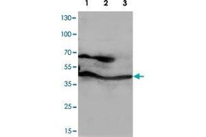 Western blot analysis of whole cell lysates with PPID polyclonal antibody . (PPID Antikörper  (C-Term))