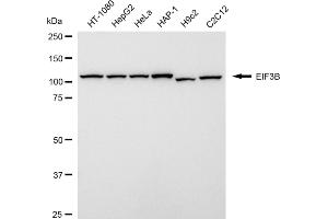 anti-Eukaryotic Translation Initiation Factor 3, Subunit B (EIF3B) antibody