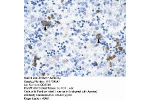 Human Liver (TRIM17 / RNF16 Antikörper  (Middle Region))