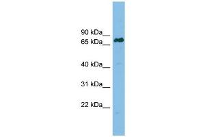 Lamin B Receptor antibody used at 1 ug/ml to detect target protein.