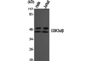 Western Blotting (WB) image for anti-Glycogen Synthase Kinase 3 alpha/beta (GSK3a/b) (Tyr216), (Tyr279) antibody (ABIN5956808) (GSK3 alpha/beta Antikörper  (Tyr216, Tyr279))