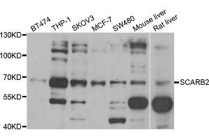 Western blot analysis of extracts of various cell lines, using SCARB2 antibody (ABIN5973710) at 1/1000 dilution. (SCARB2 Antikörper)