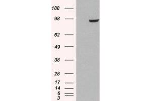 Western Blotting (WB) image for anti-phosphodiesterase 5A, cGMP-Specific (PDE5A) (C-Term) antibody (ABIN2466086) (PDE5A Antikörper  (C-Term))