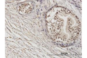 Immunoperoxidase of monoclonal antibody to ZNF92 on formalin-fixed paraffin-embedded human prostate. (ZNF92 Antikörper  (AA 490-586))