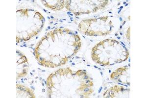 Immunohistochemistry of paraffin-embedded Human stomach using PCDHA12 Polyclonal Antibody at dilution of 1:100 (40x lens). (PCDHA12 Antikörper)