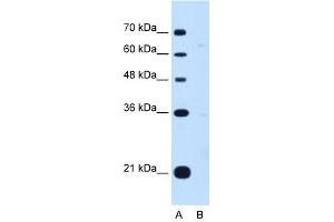 DONSON antibody used at 1 ug/ml to detect target protein. (DONSON Antikörper  (Middle Region))