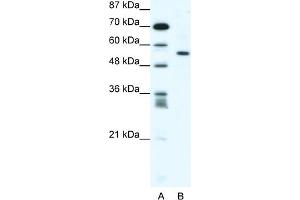WB Suggested Anti-RUNX2 Antibody Titration:  1. (RUNX2 Antikörper  (Middle Region))