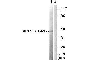 Immunohistochemistry analysis of paraffin-embedded human brain tissue using Arrestin 1 (Ab-412) antibody. (SAG Antikörper  (Ser412))
