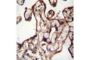 Immunohistochemistry analysis in formalin fixed and paraffin embedded human placenta tissue reacted with MORN3 Antibody (Center) followed by peroxidase conjugation of the secondary antibody and DAB staining.
