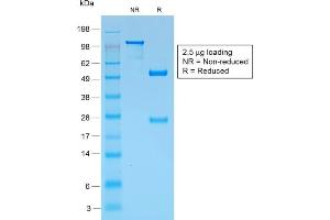 SDS-PAGE Analysis Purified gp100 Rabbit Recombinant Monoclonal Antibody (PMEL/1825R). (Rekombinanter Melanoma gp100 Antikörper)