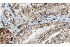 ABIN6273398 at 1/100 staining Human prostate tissue by IHC-P. (SLC34A2 Antikörper  (N-Term))