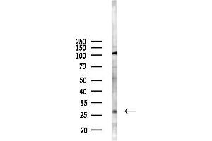 Western blot analysis of lysates from HepG2 cells(UV 30 min treatment), using NPDC1 Antibody at 1/1000 dilution.