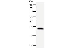 Western Blotting (WB) image for anti-DEAD (Asp-Glu-Ala-Asp) Box Polypeptide 3, X-Linked (DDX3X) antibody (ABIN933120) (DDX3X Antikörper)