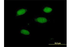 Immunofluorescence of purified MaxPab antibody to PRKRIR on HeLa cell. (PRKRIR Antikörper  (AA 1-150))