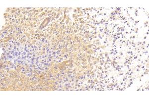 Detection of TGFbR3 in Mouse Uterus Tissue using Polyclonal Antibody to Transforming Growth Factor Beta Receptor III (TGFbR3) (TGFBR3 Antikörper  (AA 469-724))