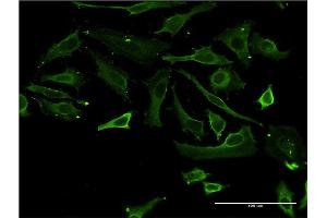 Immunofluorescence of monoclonal antibody to TSSK3 on HeLa cell. (TSSK3 Antikörper  (AA 1-268))