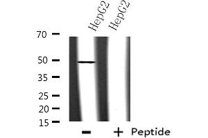 Western blot analysis of extracts from HepG2 cells, using hnRNP F antibody. (HNRNPF Antikörper  (N-Term))