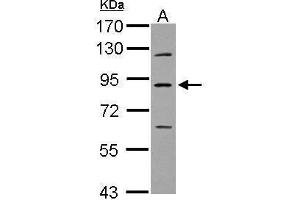 WB Image Sample (30 ug of whole cell lysate) A: U87-MG 7. (PLA2G6 Antikörper)
