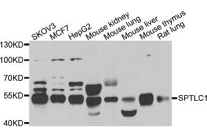 Western blot analysis of extracts of various cell lines, using SPTLC1 antibody (ABIN5974083) at 1/1000 dilution. (SPTLC1 Antikörper)