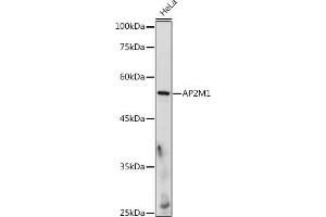Western blot analysis of extracts of HeLa cells, using M1 antibody (ABIN6129914, ABIN6136958, ABIN6136959 and ABIN6218150) at 1:500 dilution. (AP2M1 Antikörper  (AA 134-433))