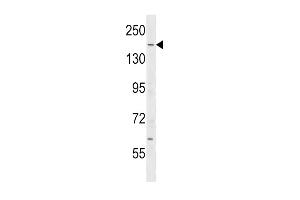 Western Blotting (WB) image for anti-IQ Motif Containing GTPase Activating Protein 2 (IQGAP2) (AA 1436-1463), (C-Term) antibody (ABIN1536724)