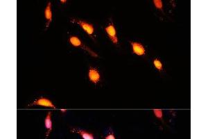 Immunofluorescence analysis of U-2 OS cells using GTF3C4 Polyclonal Antibody at dilution of 1:100 (40x lens). (GTF3C4 Antikörper)