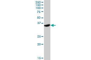 Western Blotting (WB) image for anti-Interferon gamma Receptor 2 (Interferon gamma Transducer 1) (IFNGR2) (AA 1-337) antibody (ABIN516929)