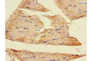Immunohistochemistry of paraffin-embedded human skeletal muscle tissue using ABIN7153920 at dilution of 1:100 (SLC37A1 Antikörper  (AA 245-302))