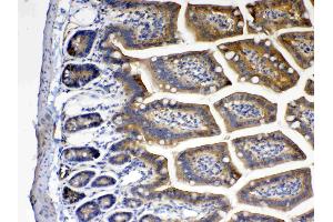 IHC analysis of CD151 using anti- CD151 antibody . (CD151 Antikörper  (AA 113-175))
