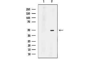 anti-Tumor Suppressing Subtransferable Candidate 1 (TSSC1) antibody