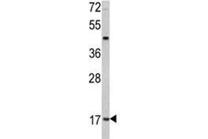 Western blot analysis of Leptin antibody MDA-MB231 lysate. (Leptin Antikörper  (AA 134-166))