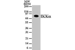 IKK alpha Western Blot. (IKK alpha Antikörper)