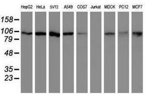 Image no. 2 for anti-Cullin 4B (CUL4B) (AA 1-300) antibody (ABIN1490726) (Cullin 4B Antikörper  (AA 1-300))
