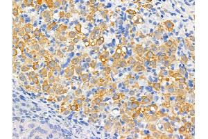 ABIN6261404 and ABIN6266530 at 1/100 staining Rat ovarian tissue by IHC-P. (Dysferlin Antikörper  (C-Term))