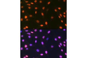 Immunofluorescence analysis of C6 cells using macroH2A. (H2AFY Antikörper)