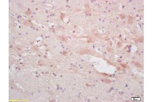Formalin-fixed and paraffin embedded rat brain labeled with Rabbit Anti NF66/alpha Internexin Polyclonal Antibody, Unconjugated (ABIN739830) at 1:200 followed by conjugation to the secondary antibody and DAB staining (INA Antikörper  (AA 251-350))