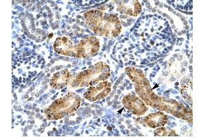 P2RX2 antibody was used for immunohistochemistry at a concentration of 4-8 ug/ml to stain Epithelial cells of renal tubule (arrows) in Human Kidney. (P2RX2 Antikörper  (Middle Region))