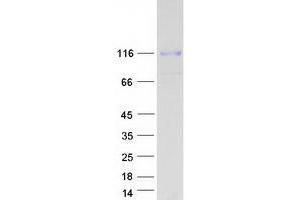 Western Blotting (WB) image for Discoidin Domain Receptor tyrosine Kinase 1 (DDR1) (Transcript Variant 3) protein (Myc-DYKDDDDK Tag) (ABIN2713453)